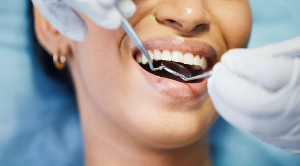 Best Emergency Denture Repair in Ilchester, MD